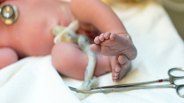 New born baby, feet and umbilical cord